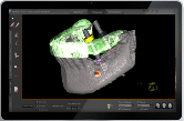 Dual Scan 3D Conebeam for Dental Implant Planning
