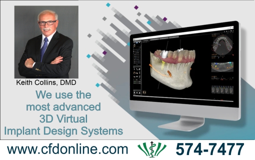 3D-Implant-Design - Collins Family and Implant Dentistry